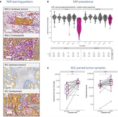 Investigating the complex interplay between fibroblast activation protein α-positive cancer associated fibroblasts and the tumor microenvironment in the context of cancer immunotherapy